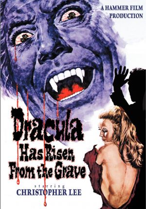 DVD