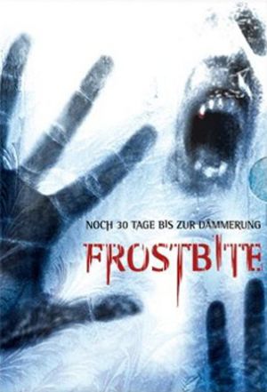 Frostbiten