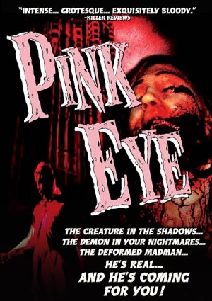 Pink Eye