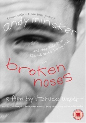 Broken Noses