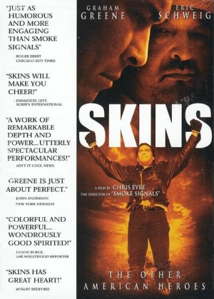 Skins