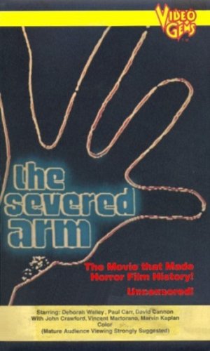 The Severed Arm