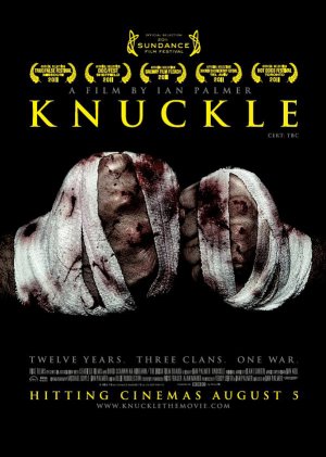 Knuckle