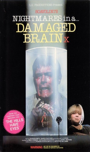 VHS