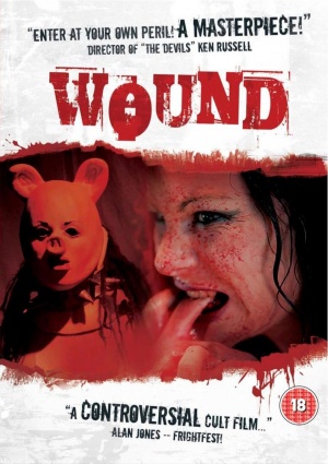 Wound