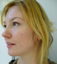 Rikke Skytte